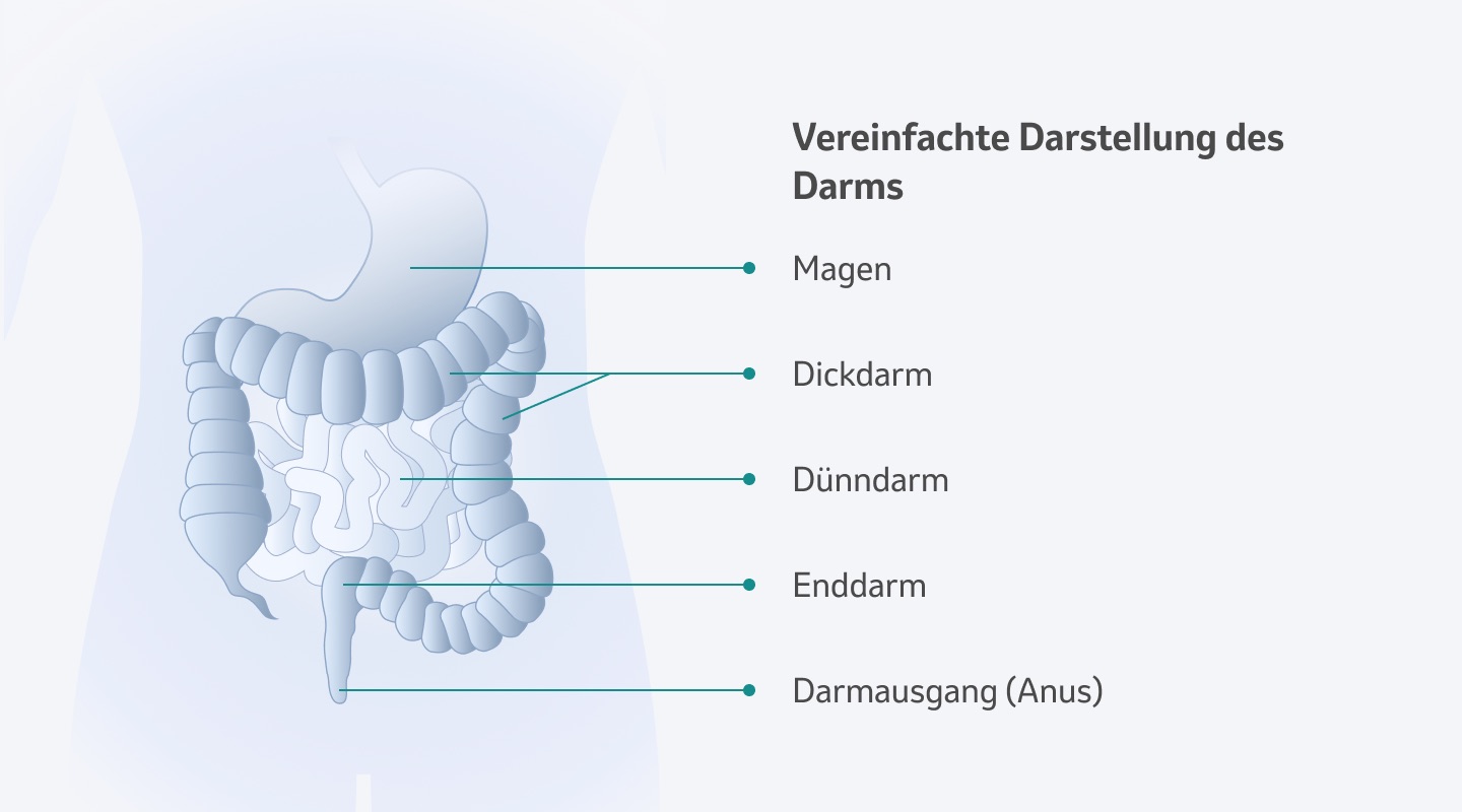 Colitis Ulcerosa Definition Msd Gesundheit Schweiz